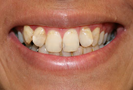 Before